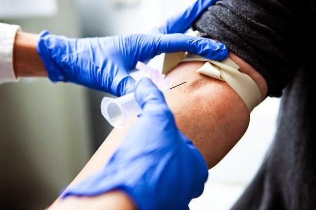 Médico tirando sangue da veia de um paciente | Testes e exames para diagnosticar o HIV